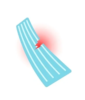Moderate (Grade 2)