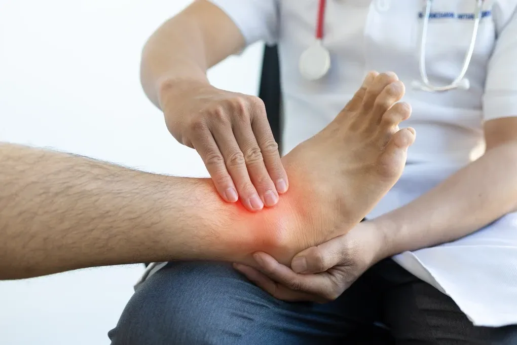5 Things to Know About Ankle Sprains