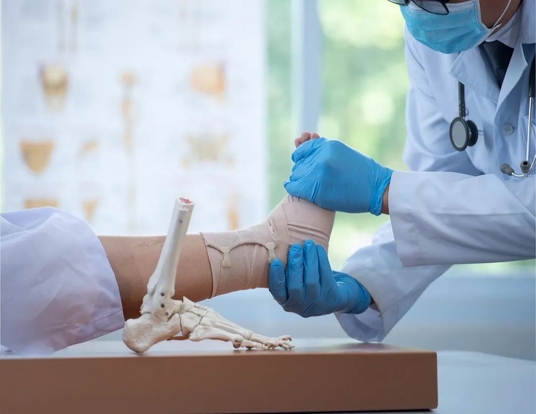 A Guide to ORIF Surgery for Ankle Fractures