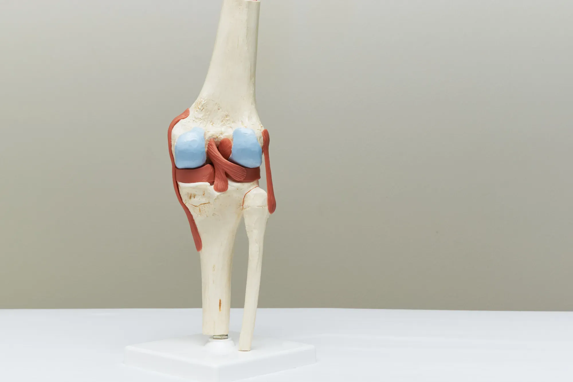 Why Early Consultation Reduces the Risk of Cartilage Loss