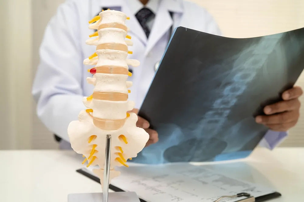 A medical professional holding up a spine X-ray film next to an anatomical human vertebrae and pelvis model on a desk.