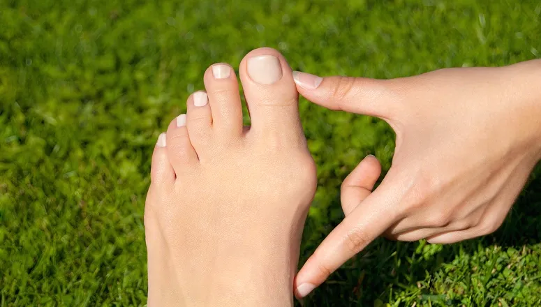 Close-up of a hand pointing to a large bunion deformity at the base of the big toe on a foot over green grass.