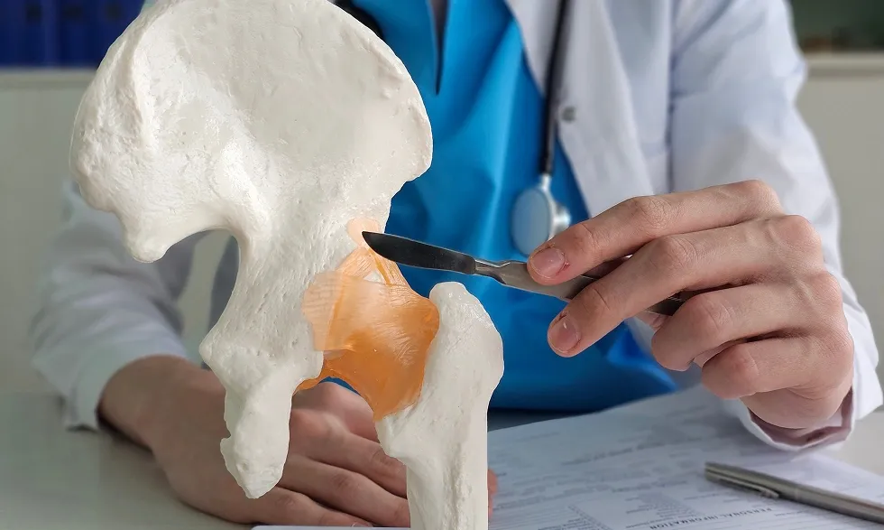 Orthopaedic specialist using a hip joint anatomy model to explain hip structure and treatment options during a consultation.