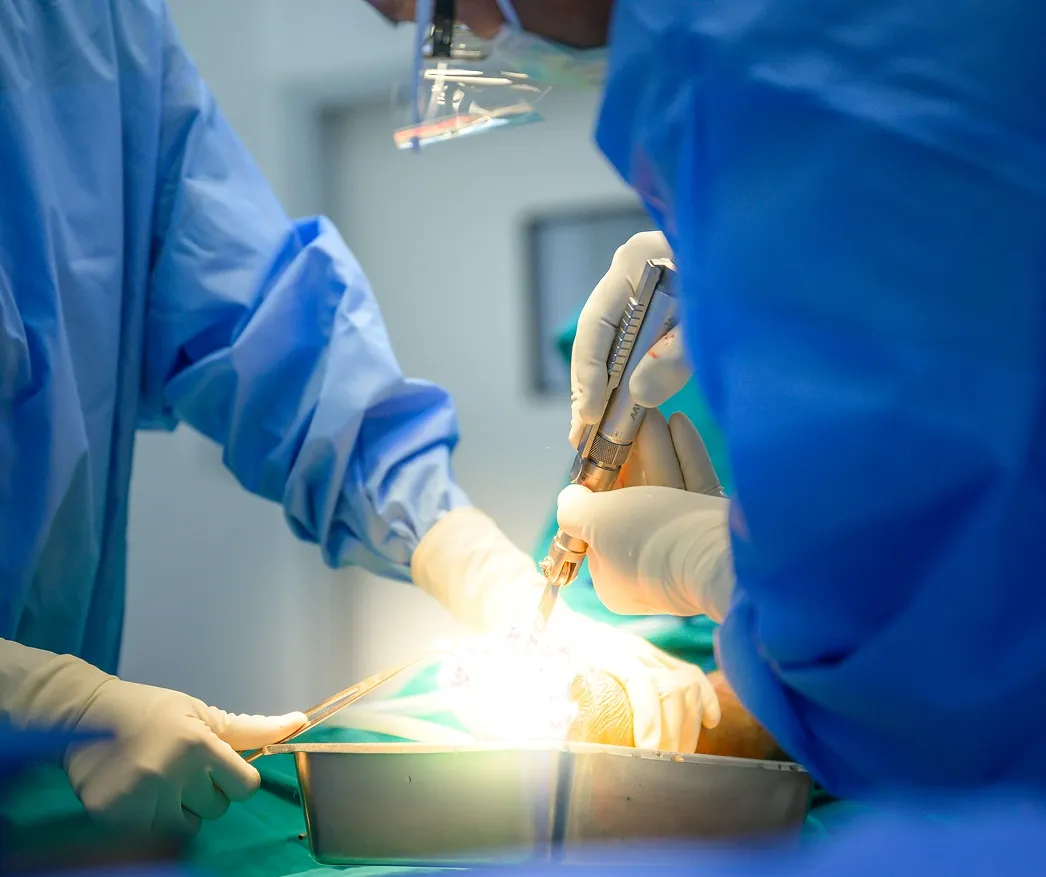 Surgeons in blue medical scrubs and sterile gloves performing an orthopedic procedure using specialized surgical power tools under intense operating lights.