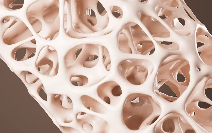 A 3D abstract rendering representing the porous microstructure of human bone affected by osteoporosis or low bone density.
